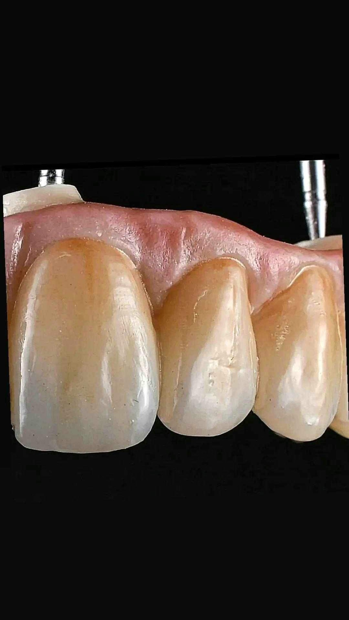 Dental Technician Career Spotlight on Ceramist, Bogdan Petre